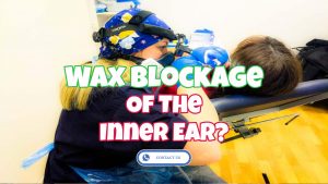 wax blockage of inner ear