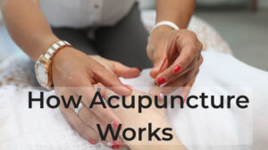 How Acupuncture Works