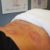 Sports Recovery Acupuncture: 6 Key Benefits to Know