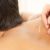 Acupuncture and Cupping for Optimal Sports Recovery